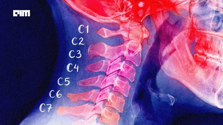 AI Is Making Cheaper MRI Machines Look Premium  
